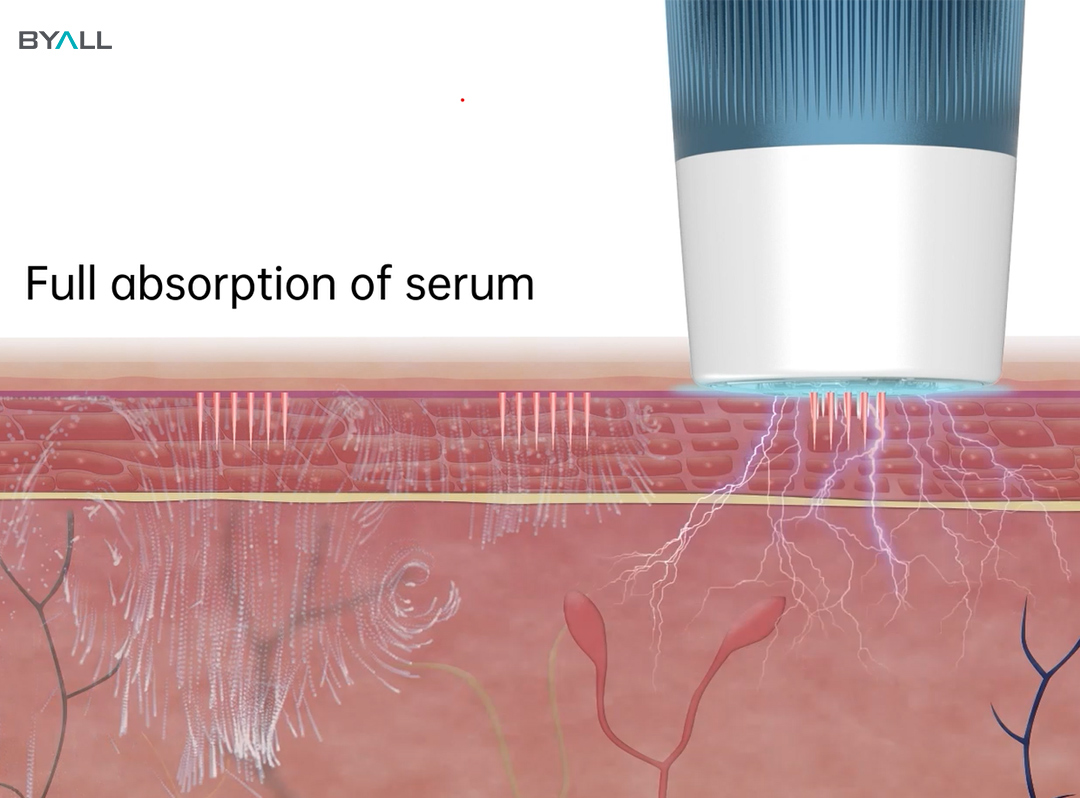Best microneedling pen for professional use