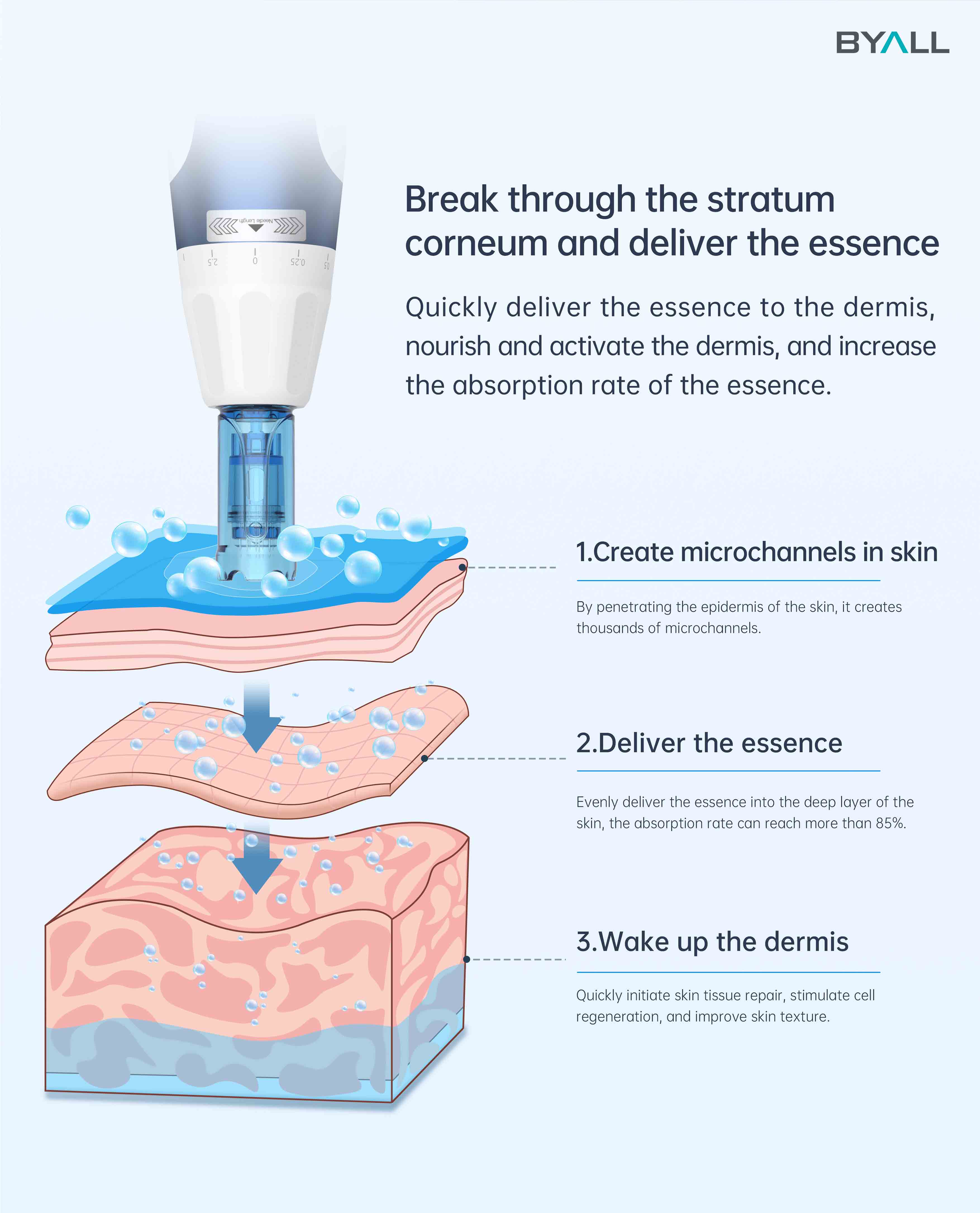 microneedling for stretch mark