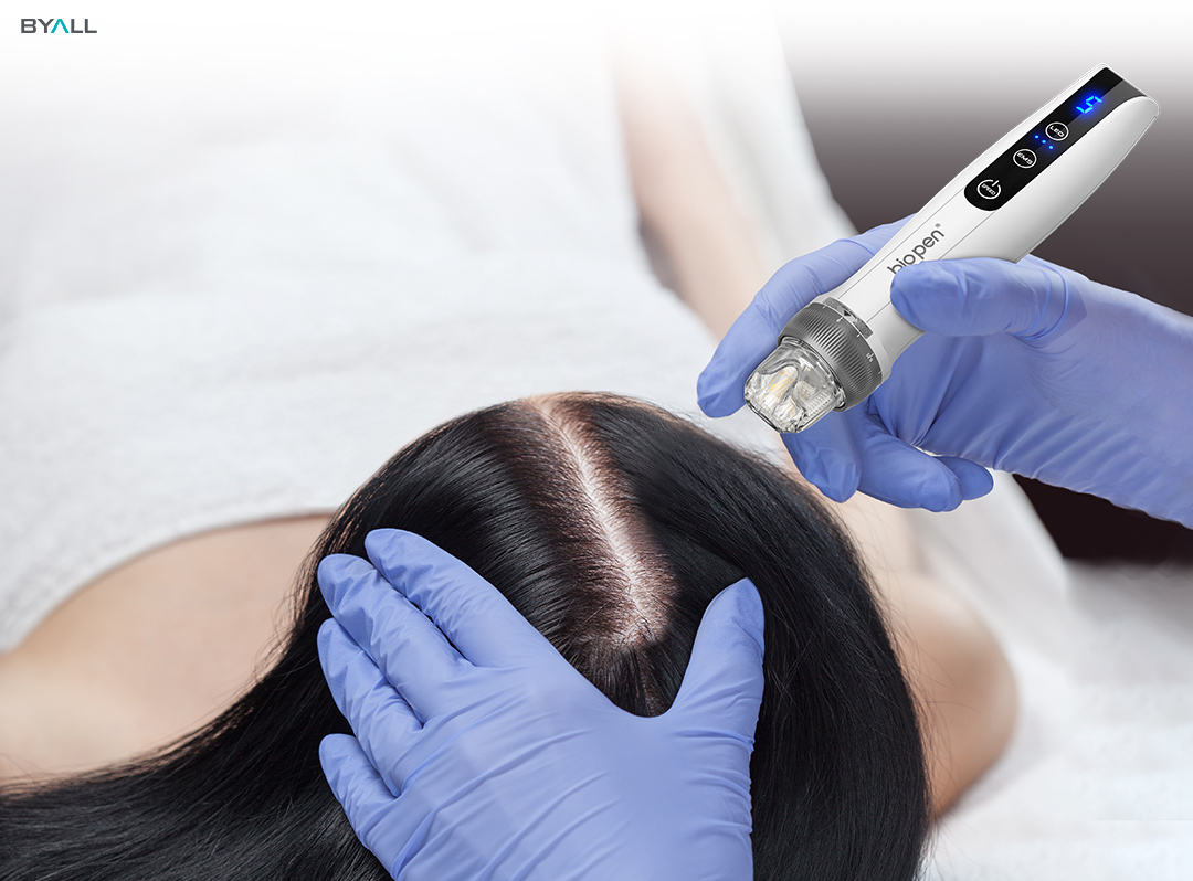microneedling scalp treatment