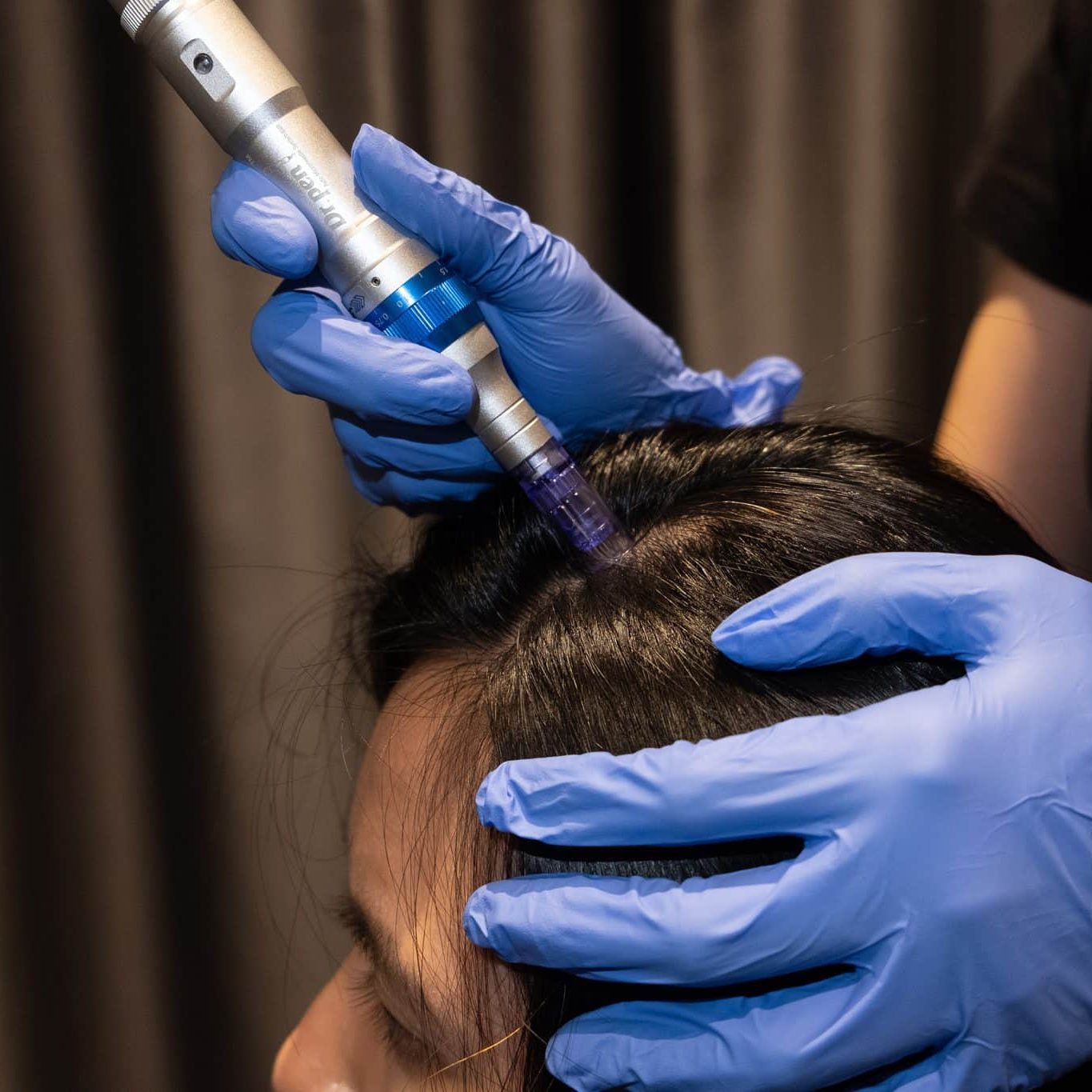 microneedling scalp treatment