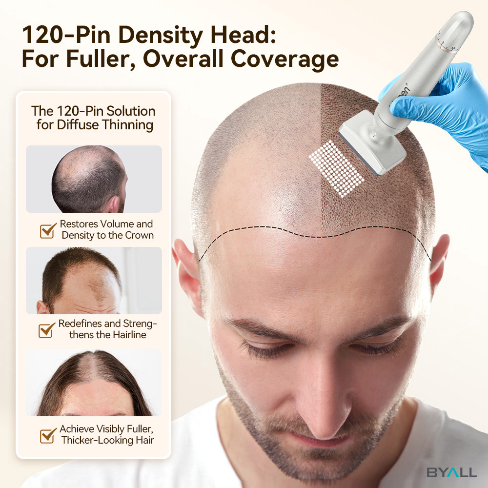 microneedling scalp treatment