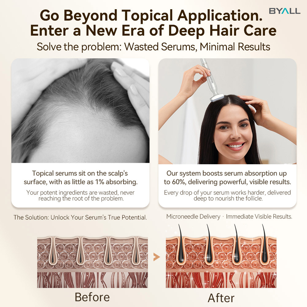 microneedling scalp treatment
